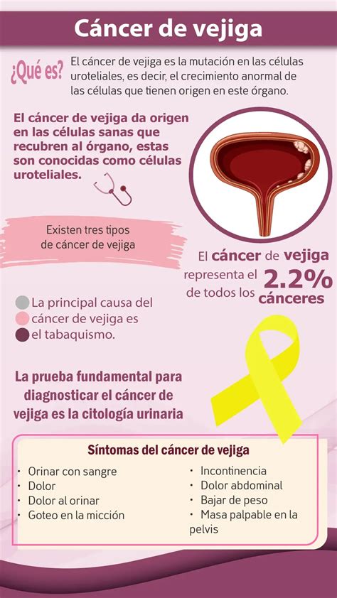 Secuencia de pruebas diagnósticas para el cáncer de vejiga