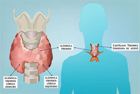 Ilustración médica mostrando la glándula tiroides y sus efectos en el cuerpo humano