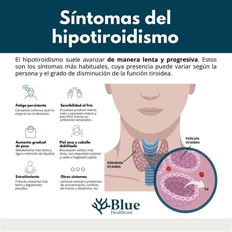 Gráfico comparativo de metabolismo en personas con y sin hipotiroidismo