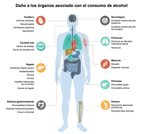 Diagrama de las consecuencias del alcohol en diferentes sistemas del cuerpo