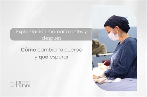 Esquema anatómico mostrando las diferentes técnicas de remodelación mamaria: aumento, mastopexia y reducción.