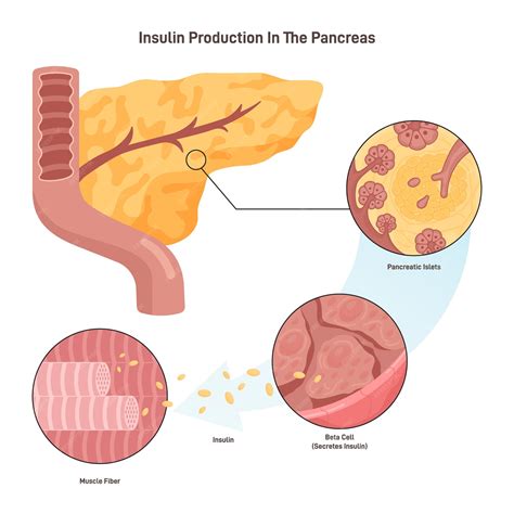 Esquema de la función de la insulina y la resistencia a la insulina en diabetes tipo 2