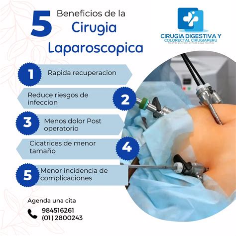 Ilustración de las pequeñas incisiones realizadas durante una laparoscopia