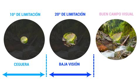 Esquema de las diferencias entre visión normal, baja visión y ceguera.