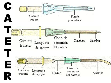 Esquema de un catéter urinario con sus partes principales