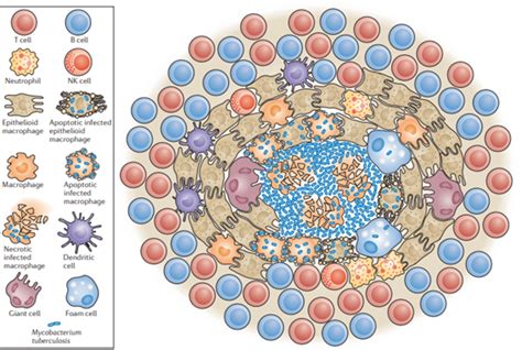 Esquema de la formación de granuloma tuberculoso