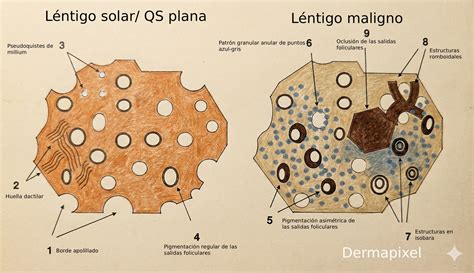 Comparación de lentigo solar y lentigo maligno