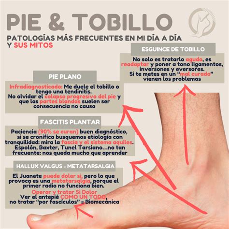 Diagrama detallado de las patologías comunes del pie en adultos mayores.