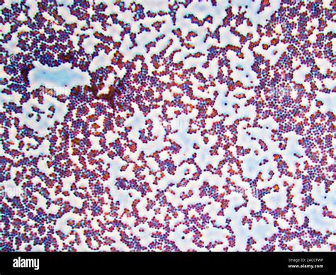 Micrografía de la bacteria Parabacteroides goldsteinii