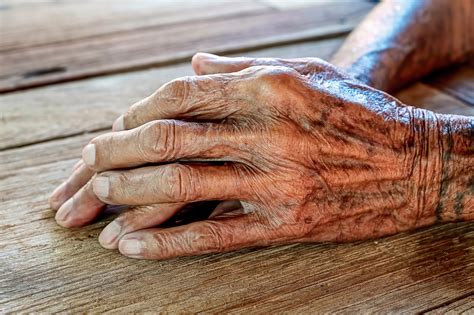 Fotografía detallada de la piel de un adulto mayor mostrando signos de envejecimiento y posibles lesiones