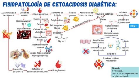 Esquema de la fisiopatología de la cetoacidosis diabética
