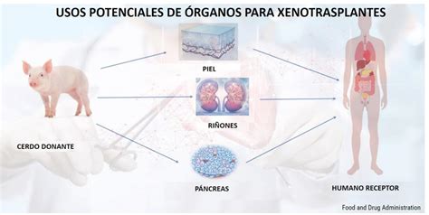 Esquema de un xenotrasplante de órgano con modificación genética