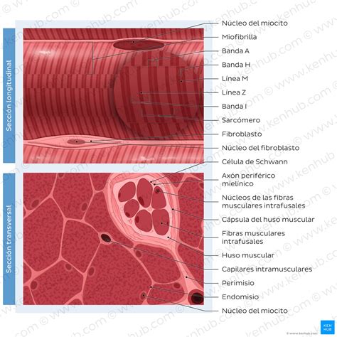 Diagrama de los pulmones mostrando el tejido cicatrizado por la silicosis.