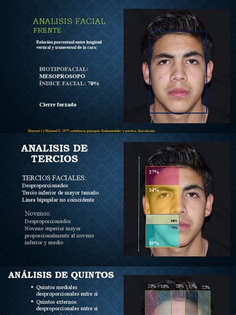 Infografía: Comparación de proporciones faciales de bebés y adultos en humanos y animales