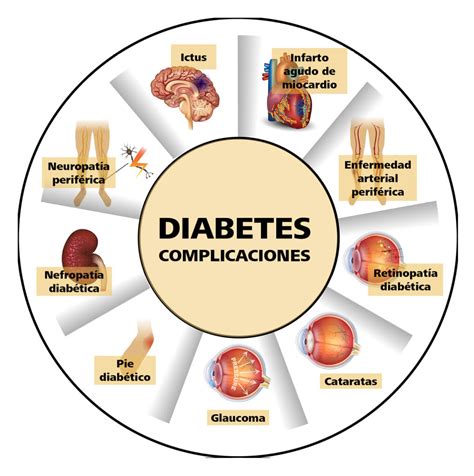 Esquema de las complicaciones de la Diabetes Mellitus tipo 2