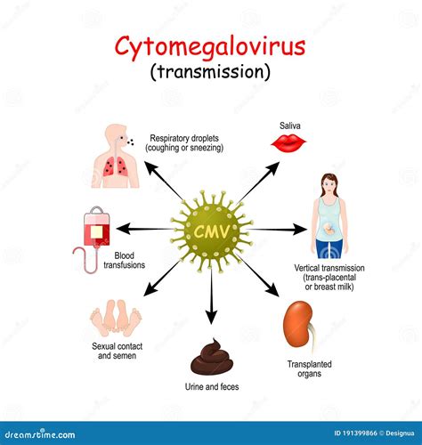 Ilustración del útero materno mostrando la transmisión del Citomegalovirus de la madre al feto.