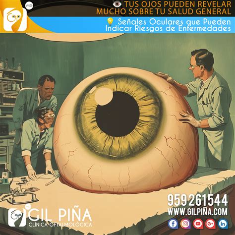 Ilustración: Síntomas oculares que requieren atención médica urgente