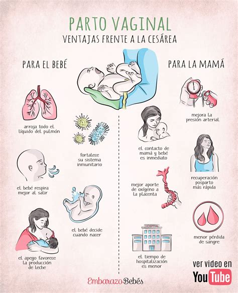 Esquema de las vías de resolución del parto: parto vaginal y cesárea