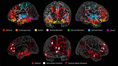 Representación gráfica de la actividad cerebral durante la resolución de un crucigrama