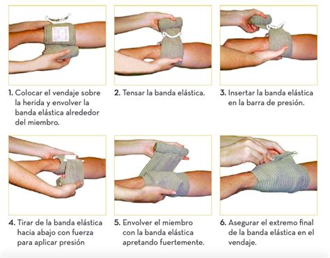 Ilustración mostrando los pasos correctos para aplicar presión en una herida en la cabeza