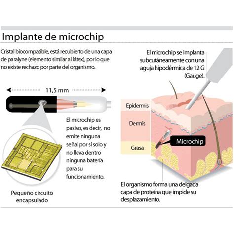 Ilustración detallada de un microchip subcutáneo y su cápsula de vidrio.