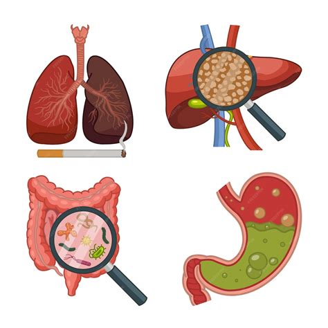 Gráfico mostrando los órganos afectados por el consumo crónico de alcohol (hígado, cerebro, corazón, sistema digestivo)