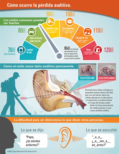 Infografía sobre estadísticas de pérdida auditiva global