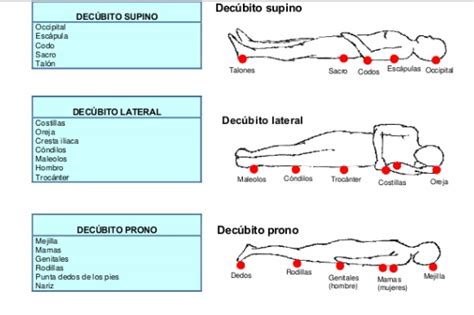 Diagrama de puntos de presión y zonas de riesgo de escaras en el cuerpo sentado