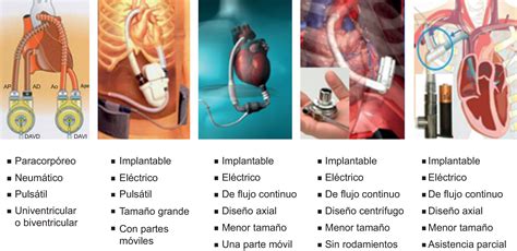 Infografía o ilustración de los dispositivos de asistencia sexual y la silla facilitadora