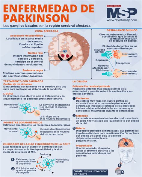 infografía sobre el cerebro afectado por la enfermedad de Parkinson, mostrando la pérdida de neuronas dopaminérgicas