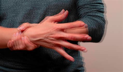 Esquema de un cuerpo humano mostrando las zonas afectadas por el temblor, rigidez y bradicinesia en la enfermedad de Parkinson