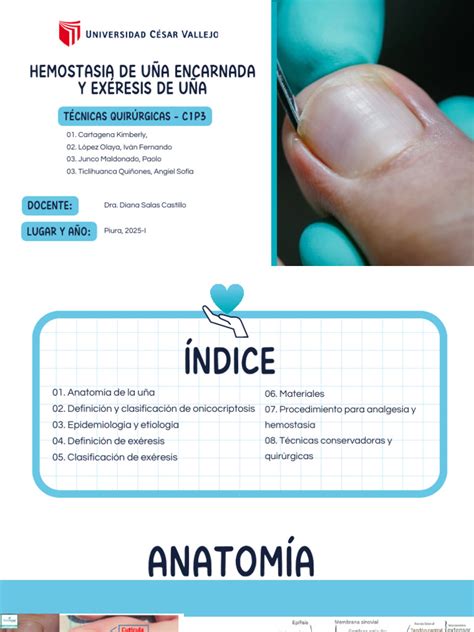 Esquema de procedimiento quirúrgico para uña encarnada o corrección de deformidad menor del pie