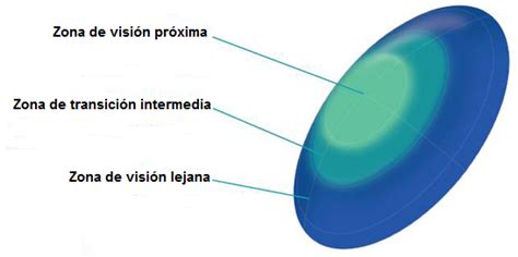 Esquema: diseño de lente de contacto multifocal moderna