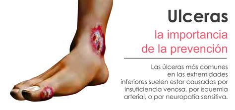 Diferentes tipos de úlceras crónicas que afectan a las personas mayores