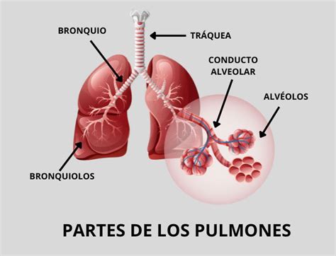 Ilustración detallada de los pulmones humanos, destacando los alvéolos afectados por la neumonía.
