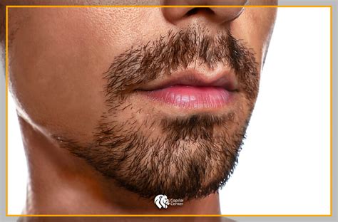 Infografía con los pasos para crear y mantener una barba de candado