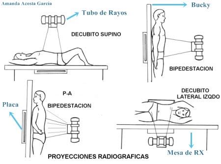 Esquema de las proyecciones radiográficas del pie (AP, lateral, oblicua)