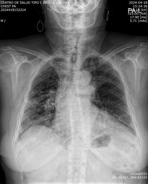 Paciente adulto mayor realizando una radiografía de pie