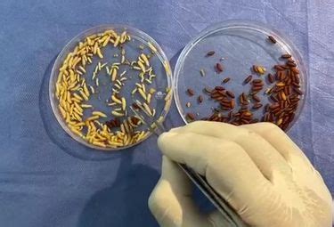 larvas de Lucilia sericata en una herida
