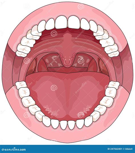 Ilustración de la boca abierta de un paciente, mostrando la lengua y las encías, con posibles hallazgos anormales.