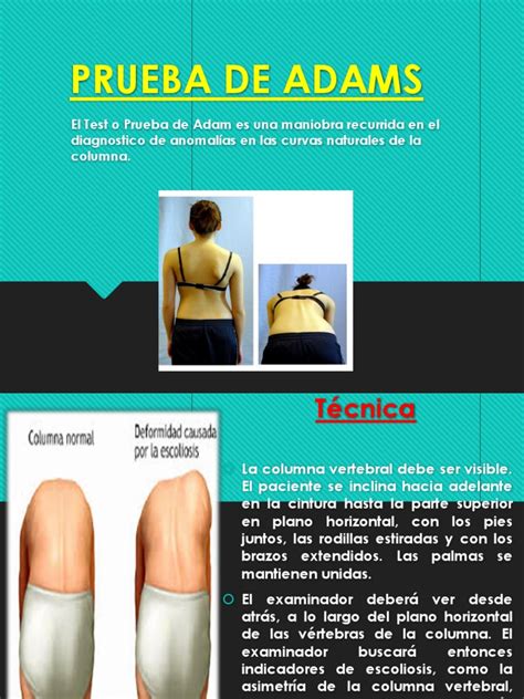 Esquema de la prueba de Adams para detectar escoliosis