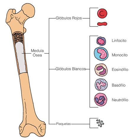 Esquema de la médula ósea y la producción de células sanguíneas, mostrando cómo las células leucémicas desplazan las células normales