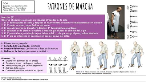 Ilustración de diferentes patrones de marcha anormales