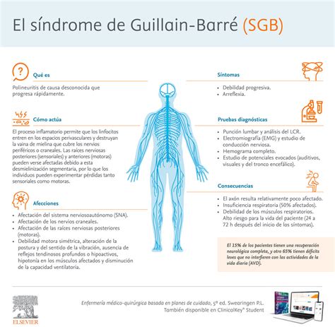 Infografía general sobre el síndrome de Guillain-Barré, mostrando el ataque del sistema inmunitario a los nervios periféricos.