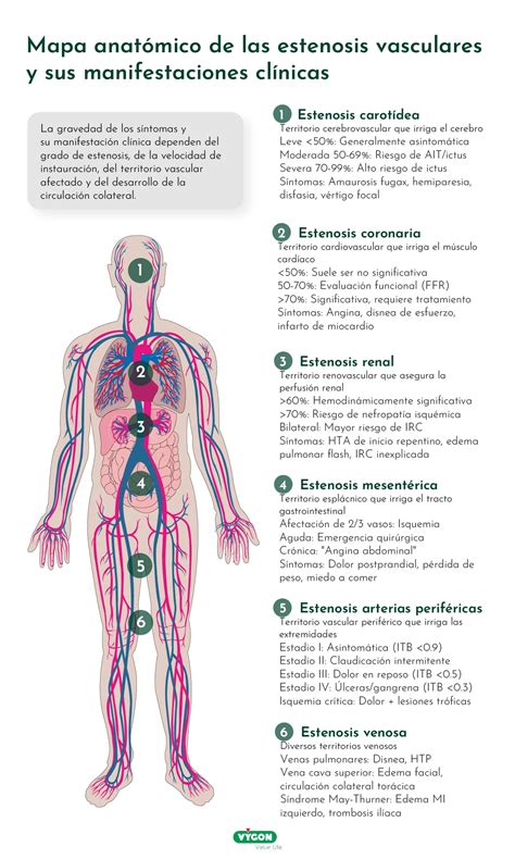 Infografía mostrando ejemplos de aneurismas y estenosis en vasos abdominales