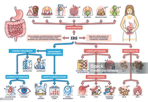 Esquema de las causas y síntomas del síndrome de decaimiento en adultos mayores