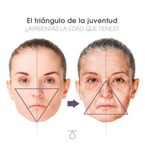 Ilustración esquemática de los cambios faciales asociados al envejecimiento, incluyendo la región perioral