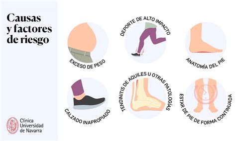 Infografía mostrando los principales factores de riesgo para la fascitis necrosante