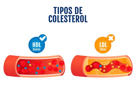 Diagrama comparativo de triglicéridos vs. colesterol