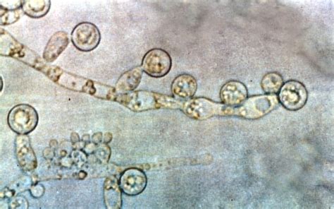 Micrografía de Candida albicans